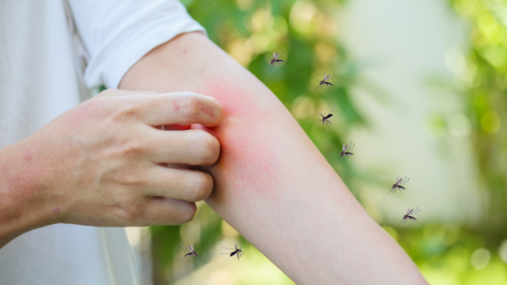 Person scratching their arm due to multiple mosquito bites while mosquitoes hover nearby